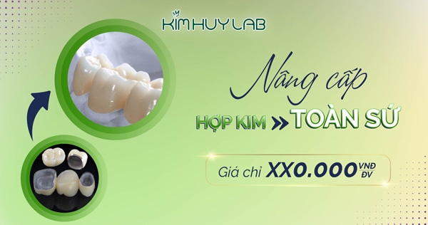 Nâng cấp hợp kim lên toàn sứ giá chỉ từ X00.000 VDN/Đv