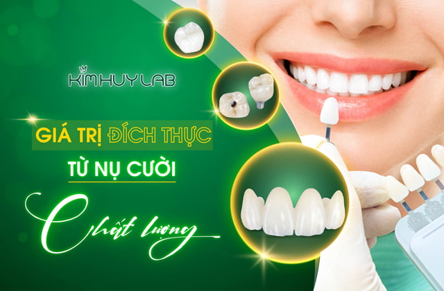 Giá trị đích thực từ nụ cười xinh